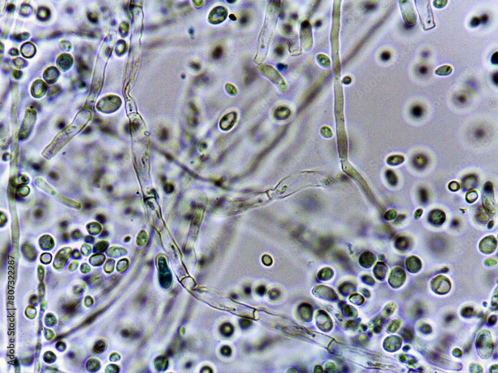 Comprehensive mold inspection process and moisture testing